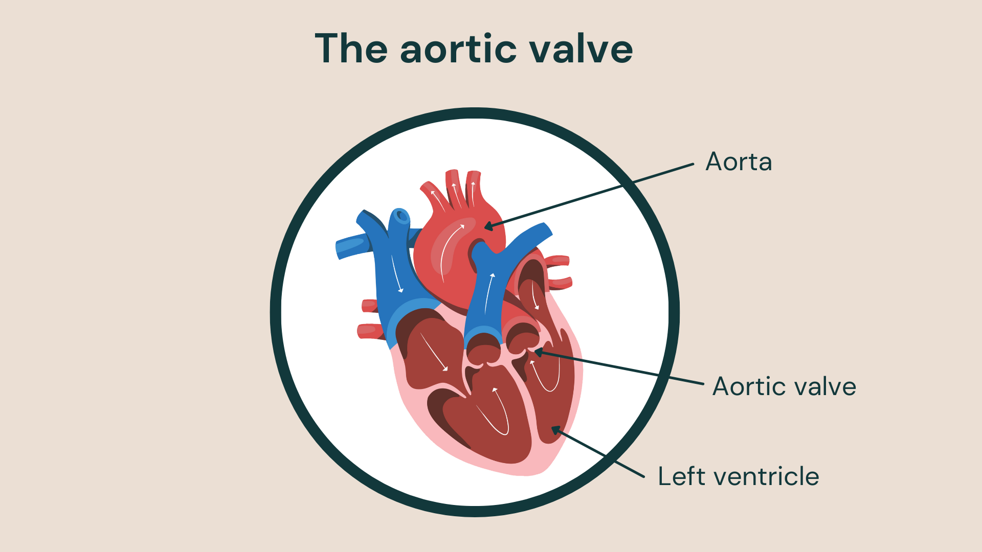 Illustration of the human heart showing the aorta, aortic valve and left ventricle.