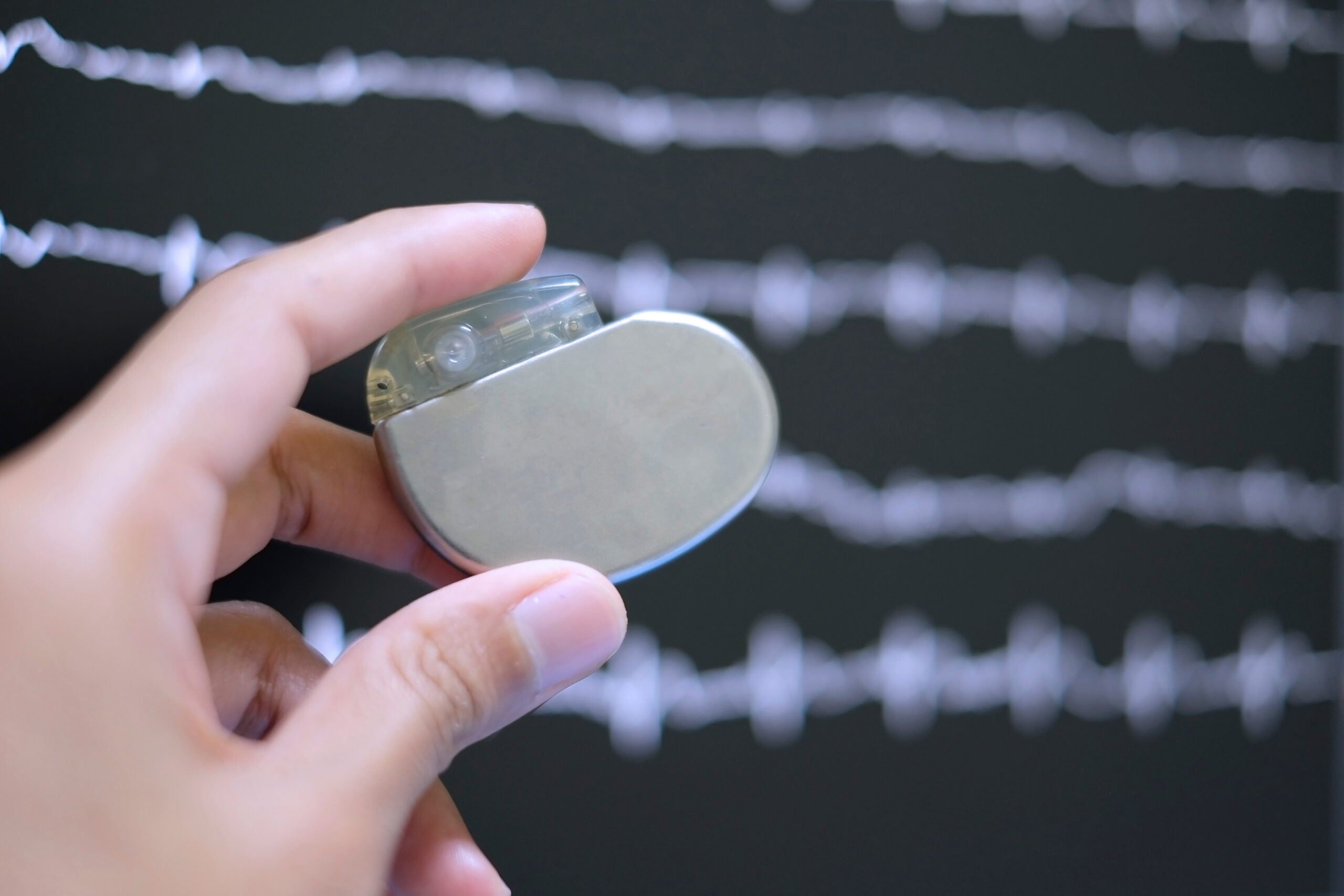 An image showing a pacemaker